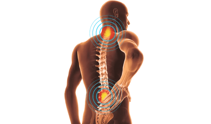 Service Provider of Slipped Disc Ayurvedic Treatment in New Delhi, Delhi, India.