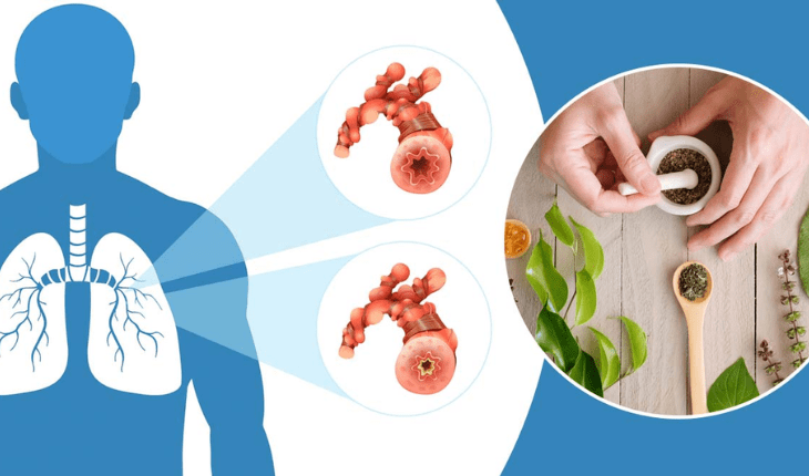 Service Provider of Asthma Ayurvedic Treatment in New Delhi, Delhi, India.
