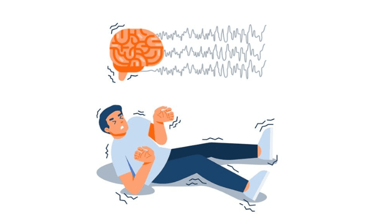 Service Provider of Epilepsy Ayurvedic Treatment in New Delhi, Delhi, India.