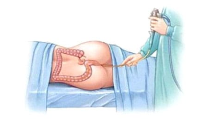 Service Provider of Kashaya Basti Ayurvedic Treatment in New Delhi, Delhi, India.